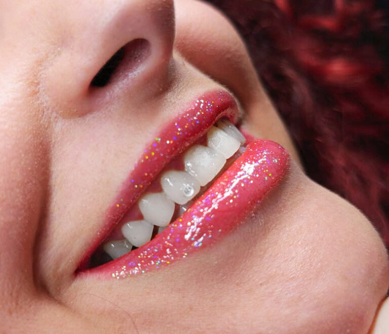 Formación gemas dentales